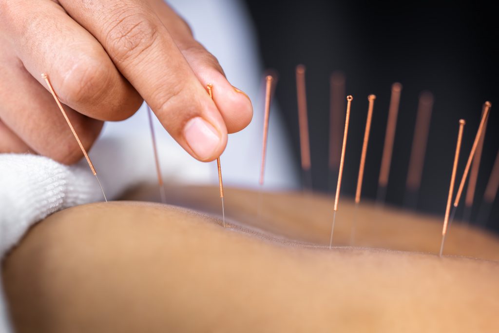 The acupuncture North York stimulates important vital centers in our body post thumbnail image